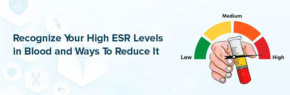 Recognize Your High ESR Levels in Blood and Ways To Reduce It